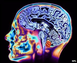 MRI